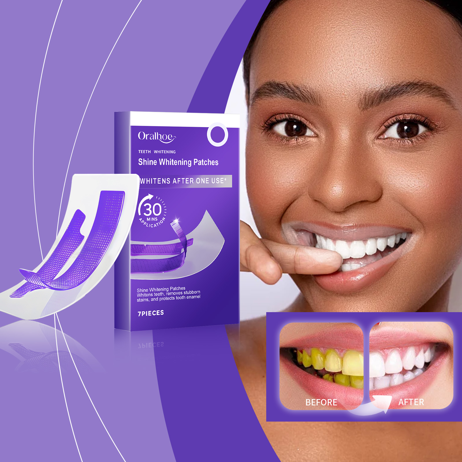 Purple Teeth Whitening Strips  - Teeth Whitening/Bleaching 评论和价格