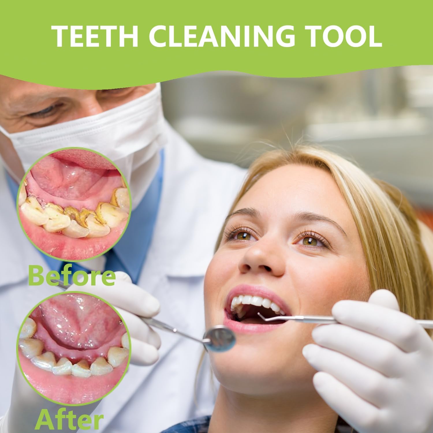 Professional Teeth Cleaning Or - Teeth Whitening Machine Professional 评论和价格
