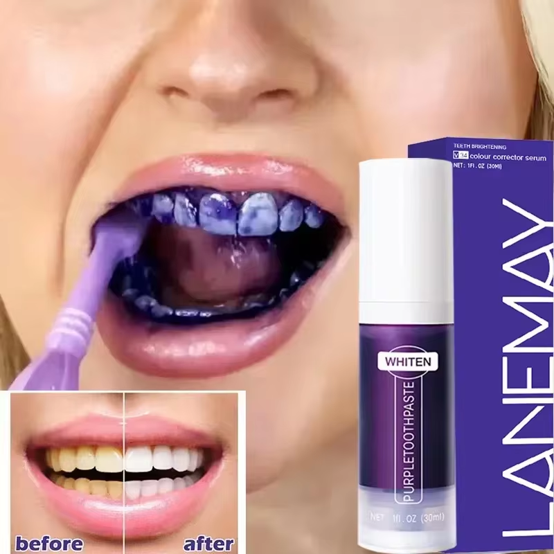 V34 Purple Teeth Whitening Too - Teeth Whitening Opalescence 评论和价格