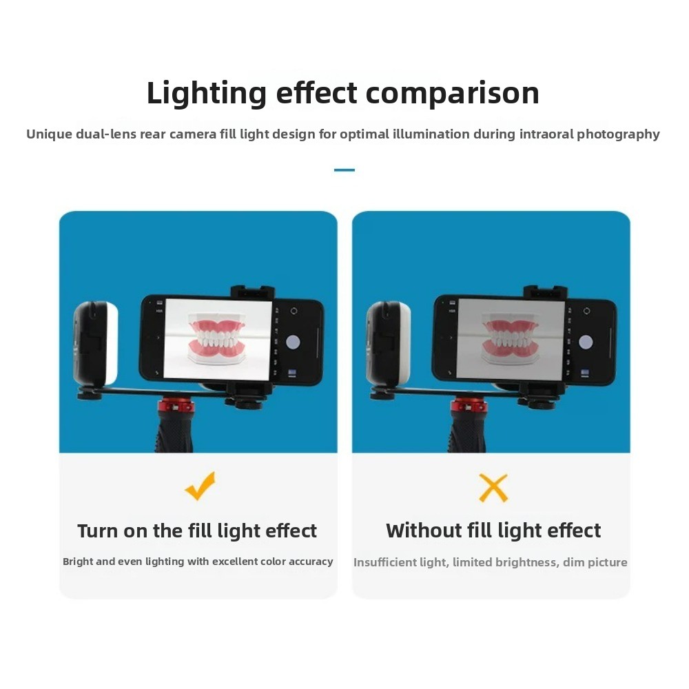 Dental Photography Light, Blue - Teeth Whitening Flash 评论和价格
