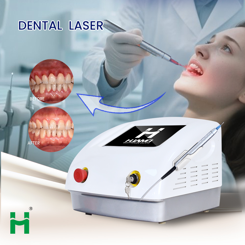Portable LED Teeth Whitening K - Teeth Whitening Bleaching Kit 评论和价格