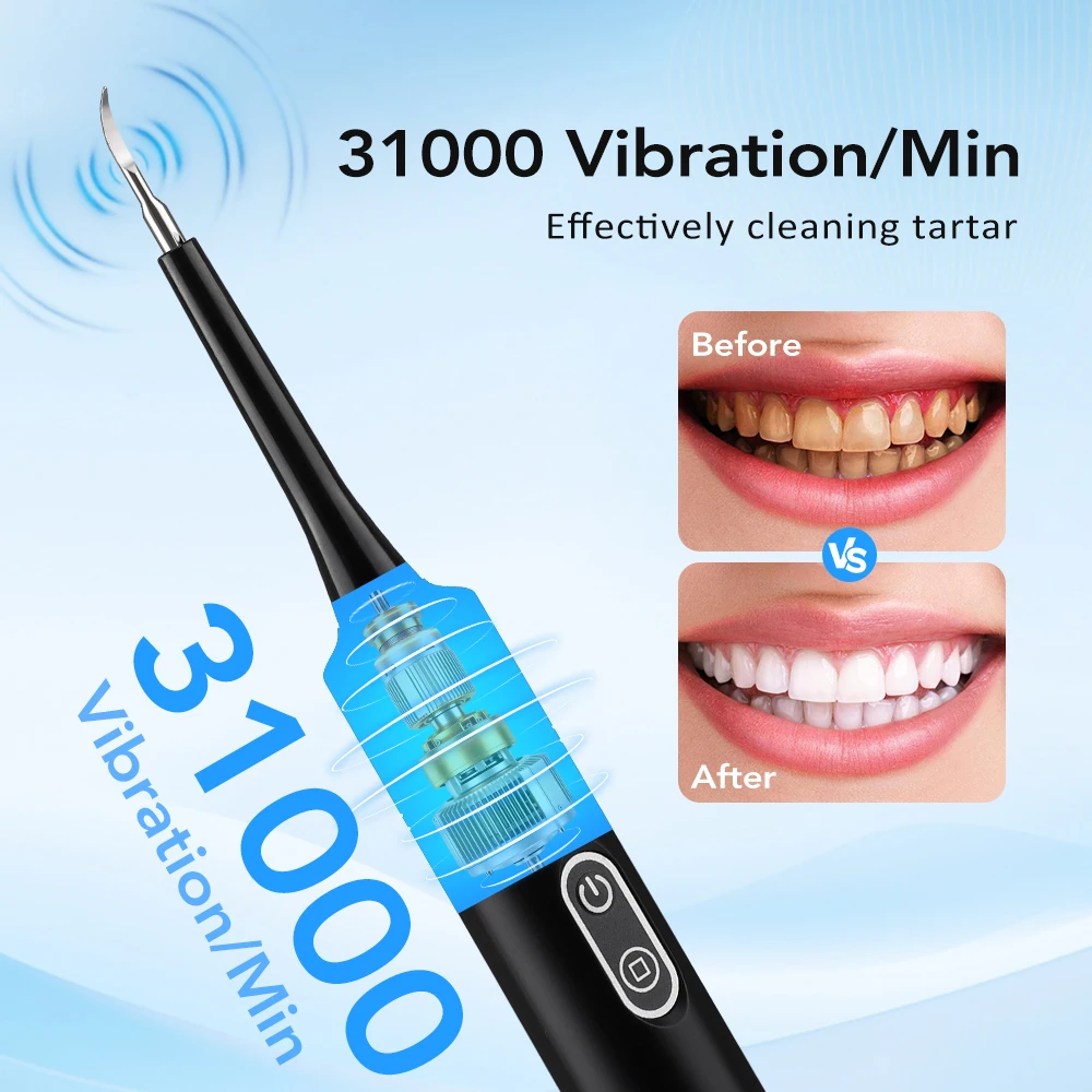 Electric Sonic Vibration Denta - Teeth Whitening Home 评论和价格